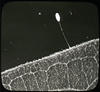Botanical : Egg of Aphis Lion